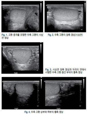 음낭 1.jpg