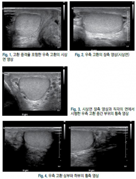 파일:음낭 1.jpg