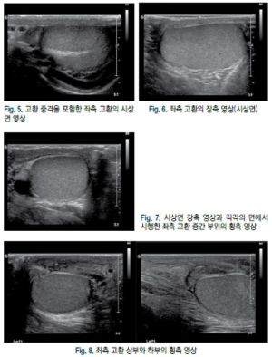 음낭 2.jpg