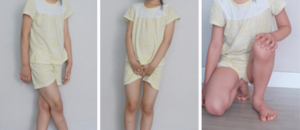 소아배뇨이상1.png