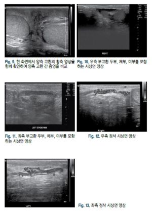 음낭 3.jpg
