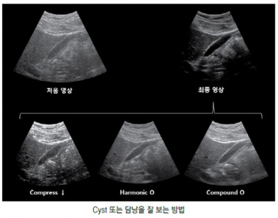 초음파 검사 장비의 기본구조 21.jpg