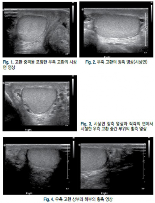 음낭 1.jpg