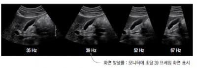 초음파 검사 장비의 기본구조 15.jpg