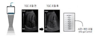초음파 검사 장비의 기본구조 8.jpg