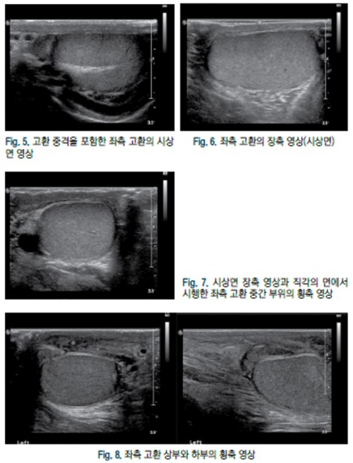 음낭 2.jpg