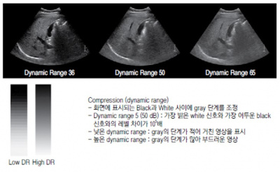 초음파 검사 장비의 기본구조 16.jpg