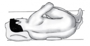 전립선 3.jpg