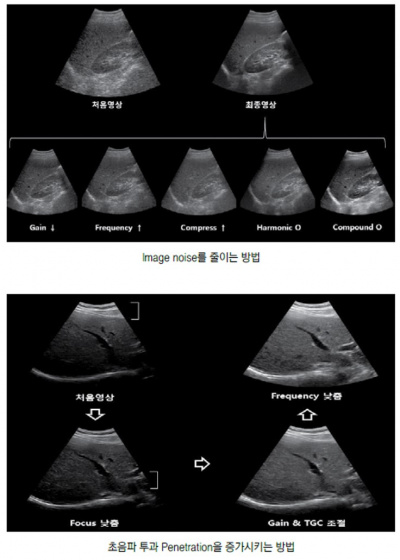 초음파 검사 장비의 기본구조 20.jpg