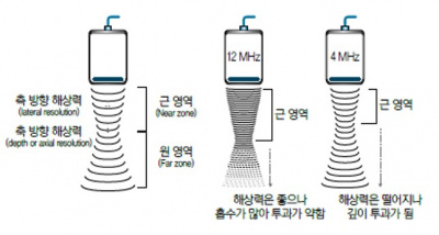 초음파 검사 장비의 기본구조 6.jpg