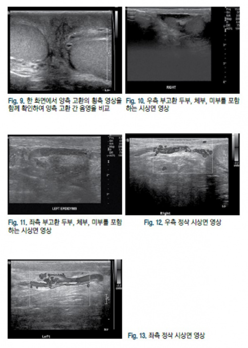 음낭 3.jpg